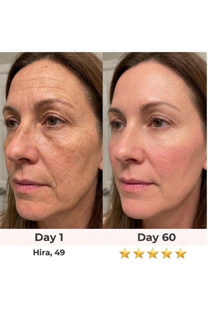 Fenorise GlowSculpt™ 7-in-1 Facial Sculptor
